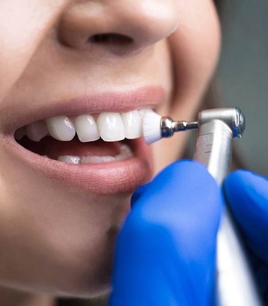 A closeup of a patient receiving cosmetic dental bonding