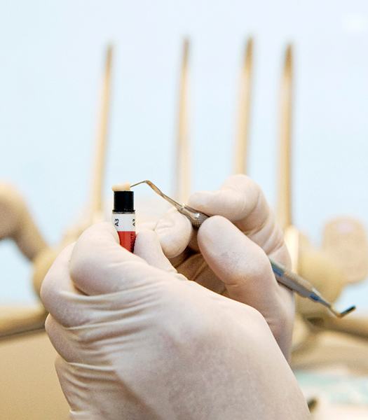 A dentist working with tooth-colored resin