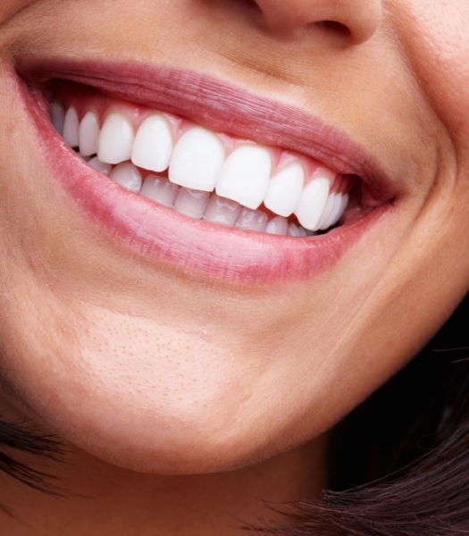 Closeup of smile after teeth whitening