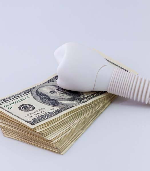 Model of a dental implant resting on a stack of money