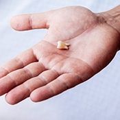 Close-up of a hand holding a lost tooth