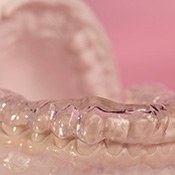 Oral appliance fitted over model teeth