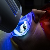 a patient undergoing in-office teeth whitening