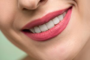 Close up of woman’s teeth